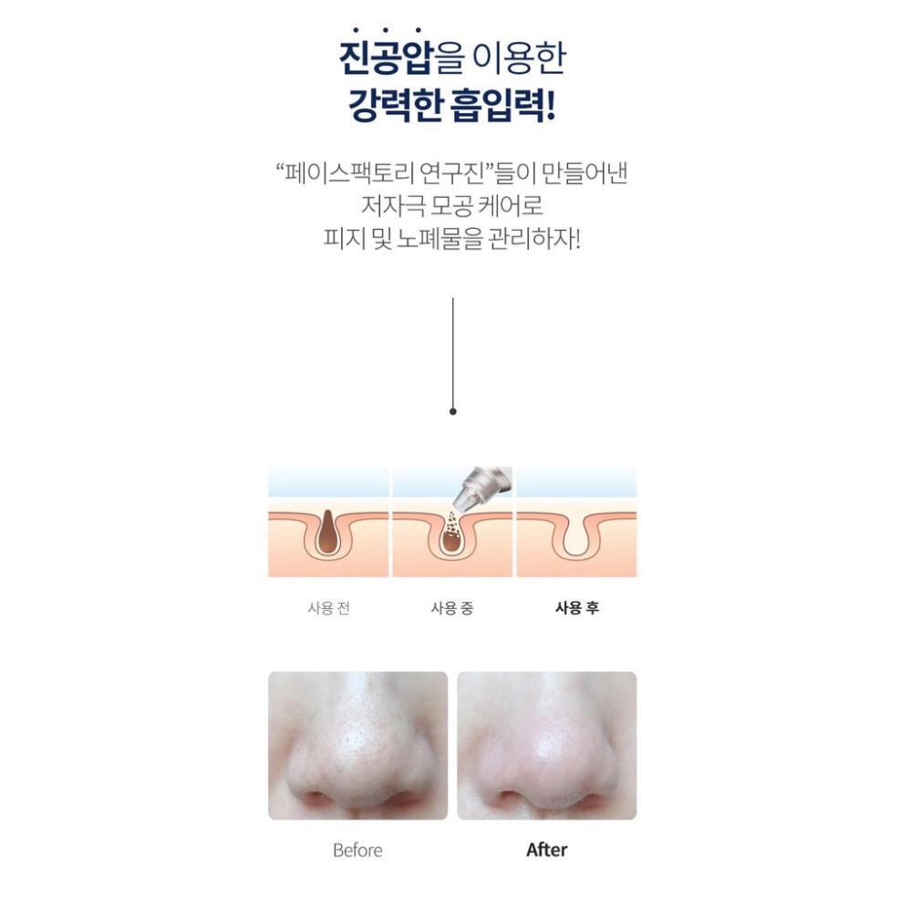 Máy hút mụn Beauty Suction Hàn Quốc