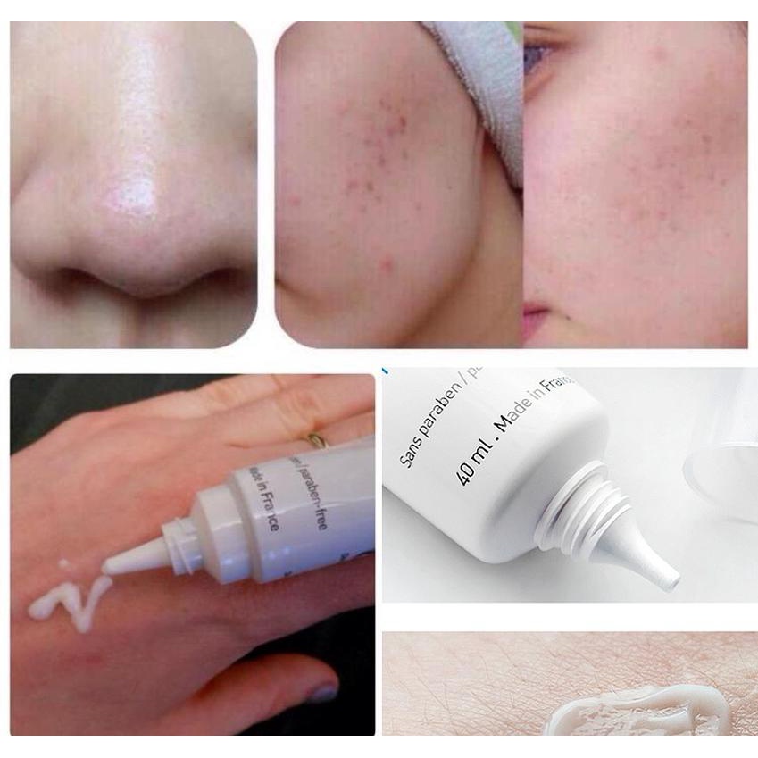 Kem Giảm Mụn La Roche-Posay Effaclar DOU+ giảm thâm, thông thoáng lỗ chân lông 40ml