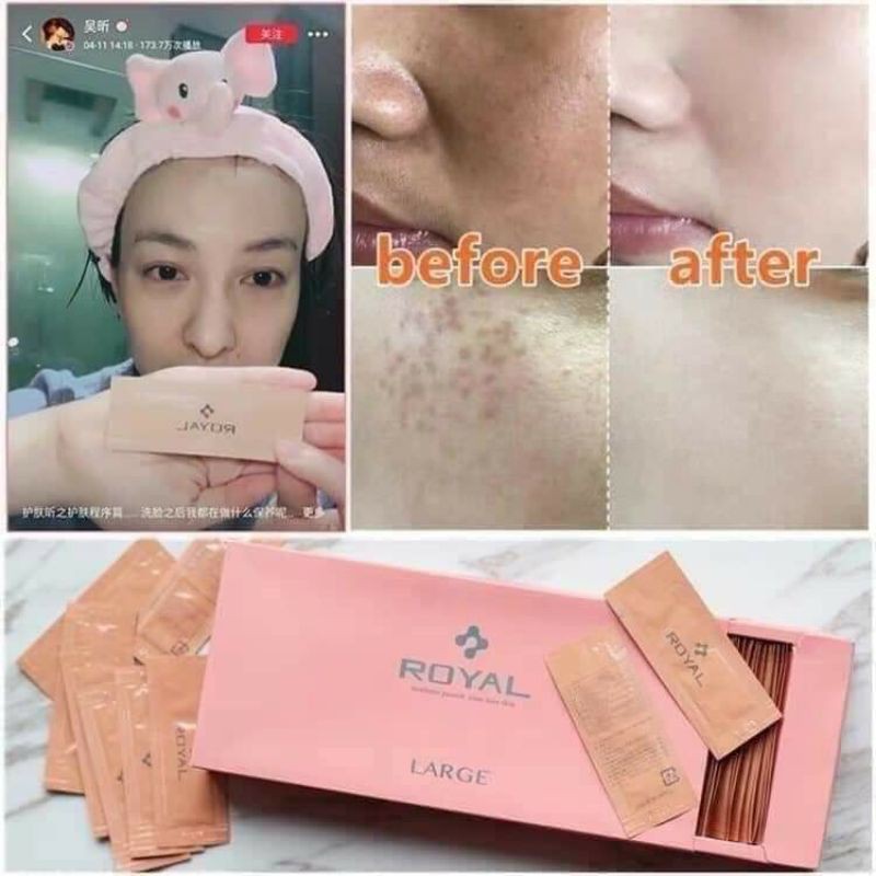 Hộp 90 gói tinh chất Serum Nhau Thai Cuống Rốn Hoang Gia Royal dưỡng da cấp ẩm thải độc