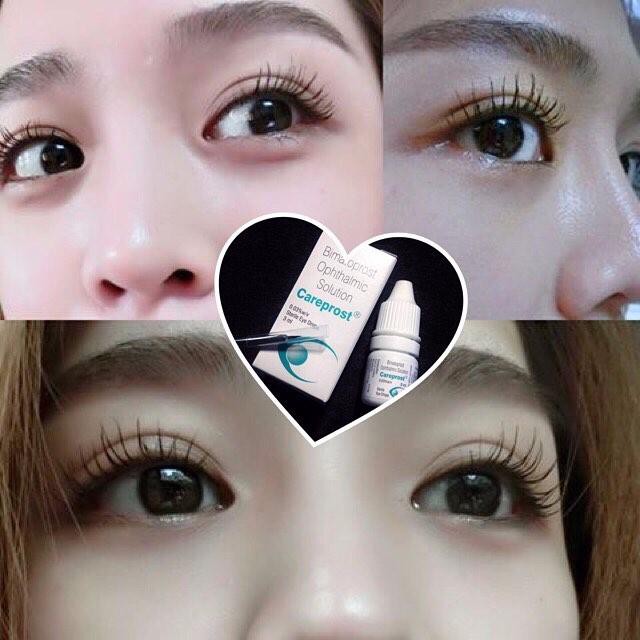 Thuốc mọc mi Dưỡng Và Hỗ Trợ Mọc Mi Cong, Mày Dài Và Dày Careprost Eyelashes Ấn Độ