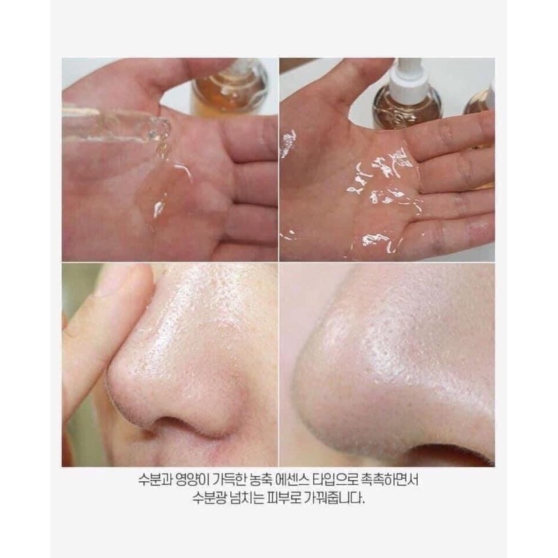 Serum se khít lỗ chân lông | BigBuy360 - bigbuy360.vn