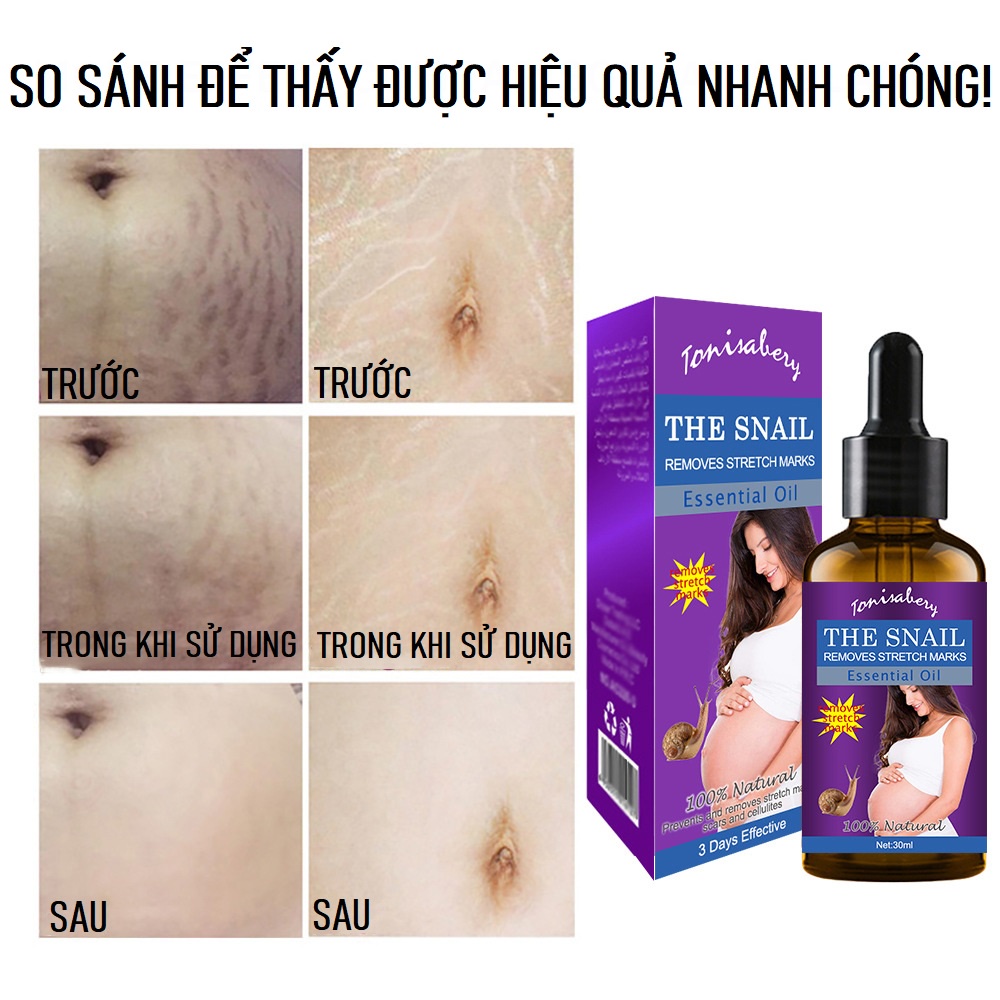 Tinh Chất Ốc Sên THE SNAIL REMOVES STRECH MARKS Giảm Sẹo Làm Mờ Vết Rạn Da, Vết Nám, Tàn Nhang, Dưỡng Trắng Da