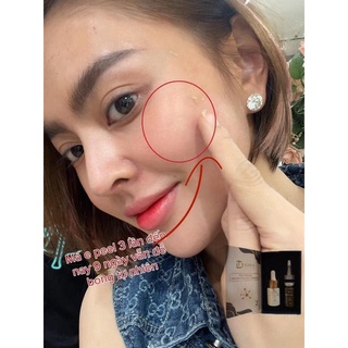 (TEM BỘ CA) Peel da Vi Tảo Retinol Trang Nemo (tem chính hãng)