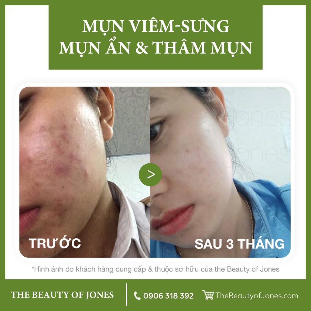 Bộ SAMPLE chăm sóc da tiện dụng khi đi du lịch The Beauty of Jones, Combo 2 Bông tẩy trang Ipek 80 miếng