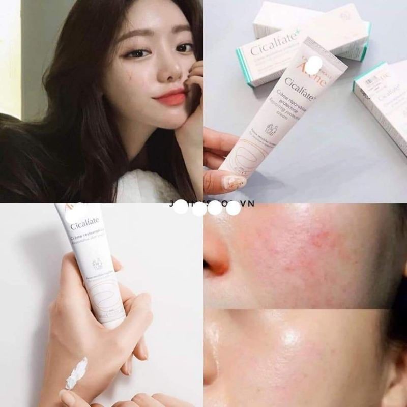 Kem dưỡng phục hồi da Avene cicalfate repair cream,
