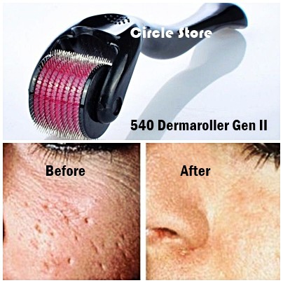 (hàng Mới Về) Máy Lăn Dermaroller Microneedle 540 Kim Bằng Thép Không Gỉ