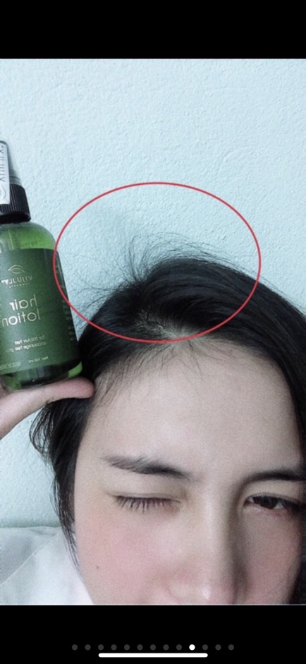 [Tặng 1 mask khổ qua 🎁 ] Tinh Dầu Bưởi kích mọc tóc Vi Jully | BigBuy360 - bigbuy360.vn