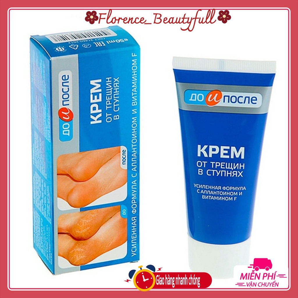 Kem giảm nứt nẻ gót chân Apteka của Nga 50ml