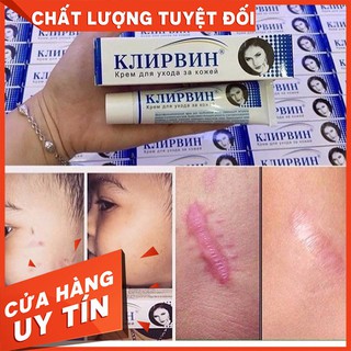 Kem mờ sẹo KLIRVIN, làm mờ sẹo thâm, sẹo lỗi, sẹo lâu năm, phục hồi tái tạo da tổn thương