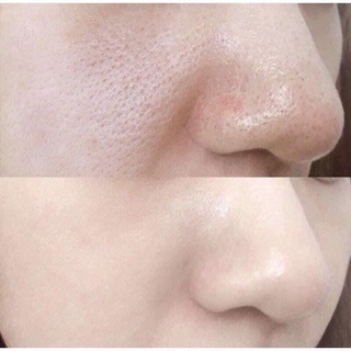 Thanh lăn mụn đầu đen mamo.de