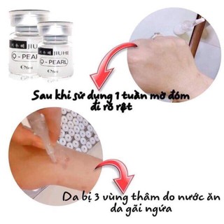 Serum mờ thâm Juihe ⚡𝗙𝗥𝗘𝗘 𝗦𝗛𝗜𝗣⚡_ hàng chuẩn