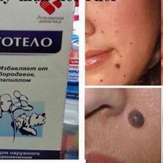 Gel chấm mụn ruồi mụn thịt Nga (lọ 3ml)