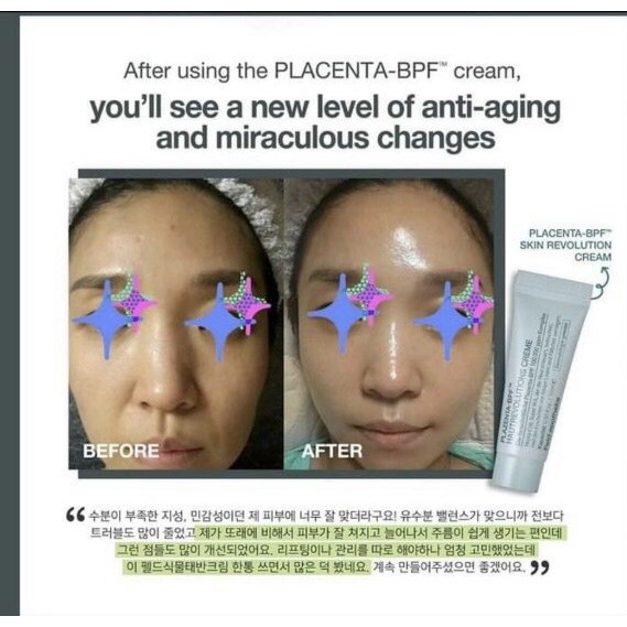 Kem nhau thai Plazenta Bpf+ 50g-Dưỡng trắng, Căng Bóng Da Chuẩn Hàn