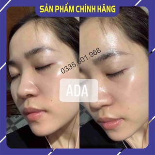Bộ 5  Căng bóng- Trẻ hoá- ADA GROUP