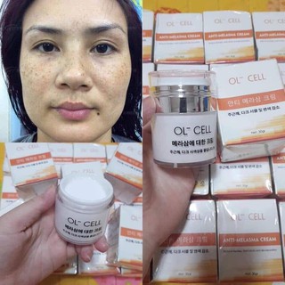 Kem hút nám tàn nhang ol cell hàn quốc