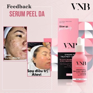[combo ] serum peel da dạng nhẹ vnb