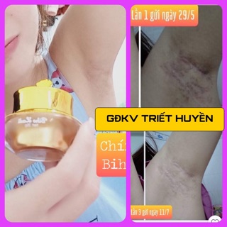 SIÊU DƯỠNG THÂM 5S BIHOLADI