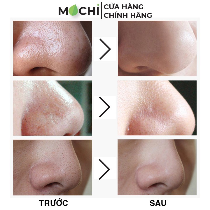 Gel Lột Mụn Đầu Đen l Mụn Cám Than Tre Hoạt Tính Mask Mặt Nạ Sạch Mụn Activated Carbon images Nội Địa Trung MOCHI SHOP | BigBuy360 - bigbuy360.vn