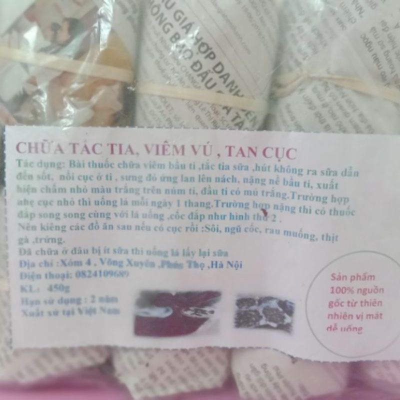 VIÊM TẮC TIA SỮA ÁP XE 5 thang 5 ngày