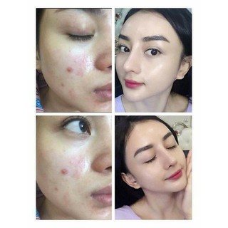 Kem sữa non collagen