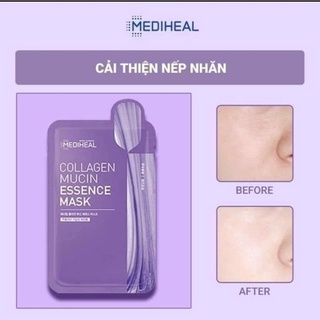 Sẵn Mặt Nạ Giấy Mediheal