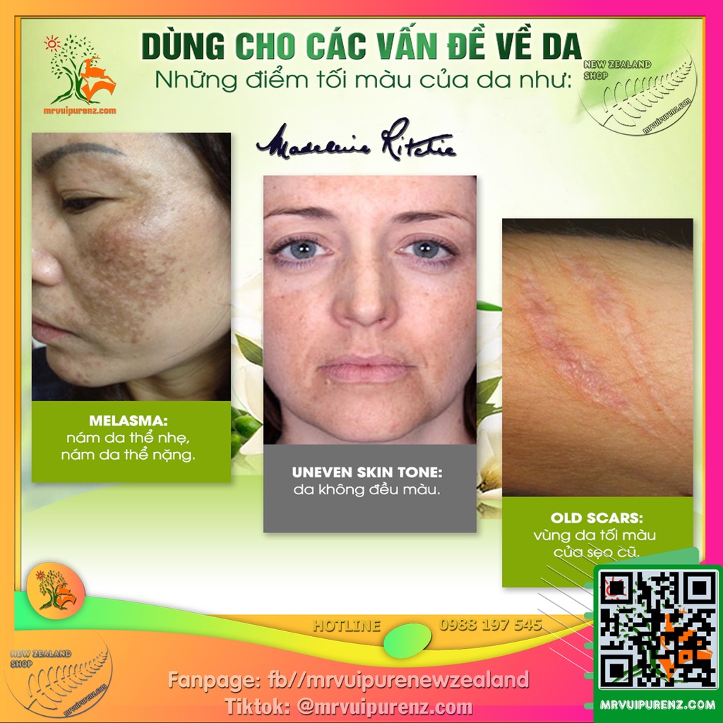 KEM DƯỠNG LÀM MỜ VẾT THÂM, GIẢM TÀN NHANG MADELEINE RITCHIE DARK SPOT REMOVER | BigBuy360 - bigbuy360.vn