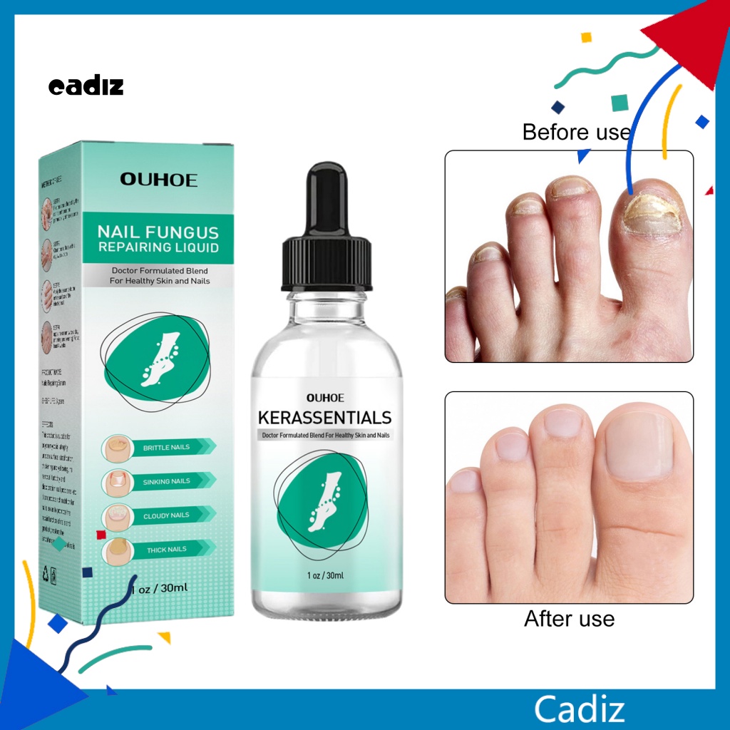 Tinh Chất Nuôi Dưỡng Và Phục Hồi Móng Hiệu Quả