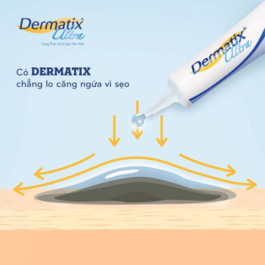 [CHÍNH HÃNG] Dermatix® Ultra – GEL LÀM MỜ SẸO – 15g