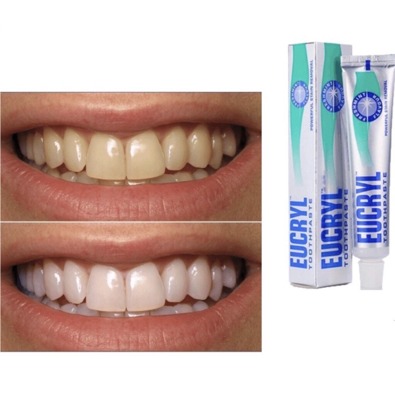 Kem đánh răng tẩy trắng Eucryl Toothpaste 62g