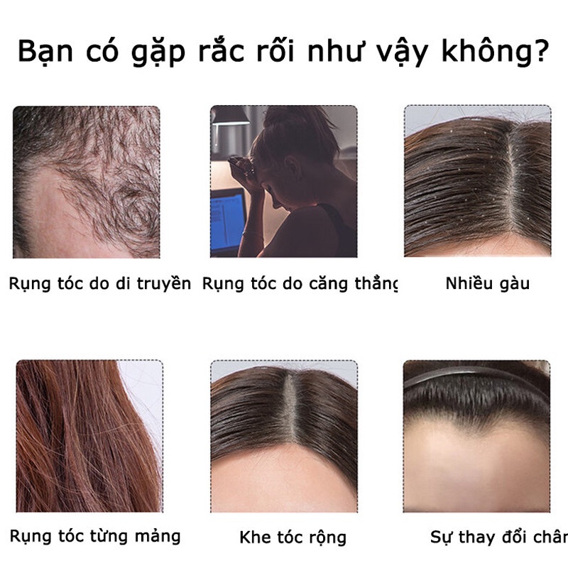 Bộ dầu gội ngăn rụng tóc dầu gội chống rụng tóc chết xuất gừng tươi có thể kích mọc tóc nhanh