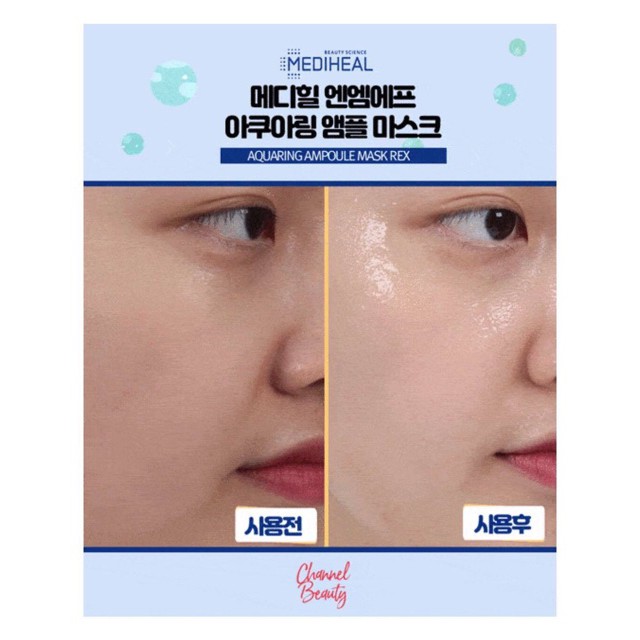 Mặt Nạ Mediheal Siêu Cấp Ẩm Phiên Bản 2 Bước N.M.F Aquaring Mask Ampoulex