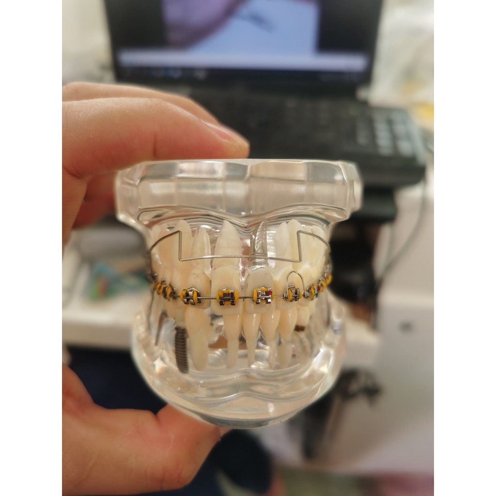 Cung tiện ích chỉnh nha, cung đánh lún ,dây SS mỹ