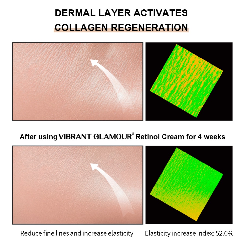 Còn Hàng Sống Động Glamour 20G Retinol Mắt Loại Bỏ Quầng Thâm, Làm Giảm Các Đường Nhăn Và Làm Sáng Da Cá Tuyết