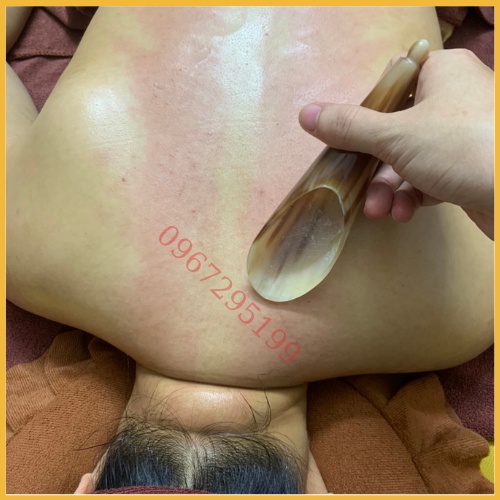 Dụng cụ Cạo gió, ấn huyệt massage bằng Sừng Trâu bài độc cơ thể video thật