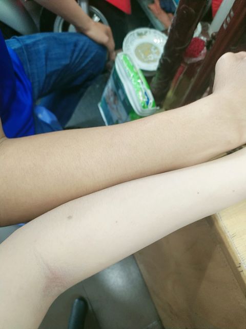 Ủ Trắng Body | BigBuy360 - bigbuy360.vn