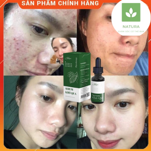 Serum dưỡng da/serum duong da Tinh Chất Khổ Qua rừng LimFarm-Giảm Mụn Mờ Thâm , Chống Lão Hóa