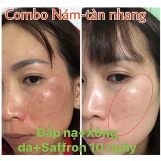 Kem nám safron💄[𝐒𝐀𝐋𝐄 𝐒𝐎̂́𝐂] 💄𝐊𝐞𝐦 𝐍𝐚́𝐦 𝐒𝐚𝐟𝐟𝐫𝐨𝐧 𝐇𝐚̉𝐢 𝐚̂𝐮 𝐯𝐢𝐞̣̂𝐭-𝐡𝐞̂́𝐭 𝐧𝐚́𝐦-𝐬𝐚̣𝐜𝐡 𝐦𝐮̣𝐧-𝐝𝐮̛𝐨̛̃𝐧𝐠 𝐭𝐫𝐚̆́𝐧𝐠