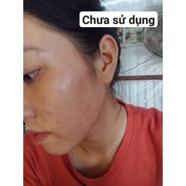 COMBO FECA SERUM SỮA RỮA MẶT COLLAGEN GK CHÍNH HÃNG