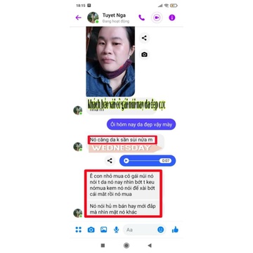 Kem face sữa 5in1 Cô gái Núi - Dưỡng trắng - dưỡng da mỏng yếu
