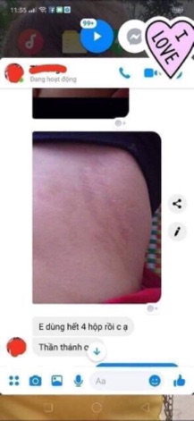KEM RẠN MULTI 16 Hũ to