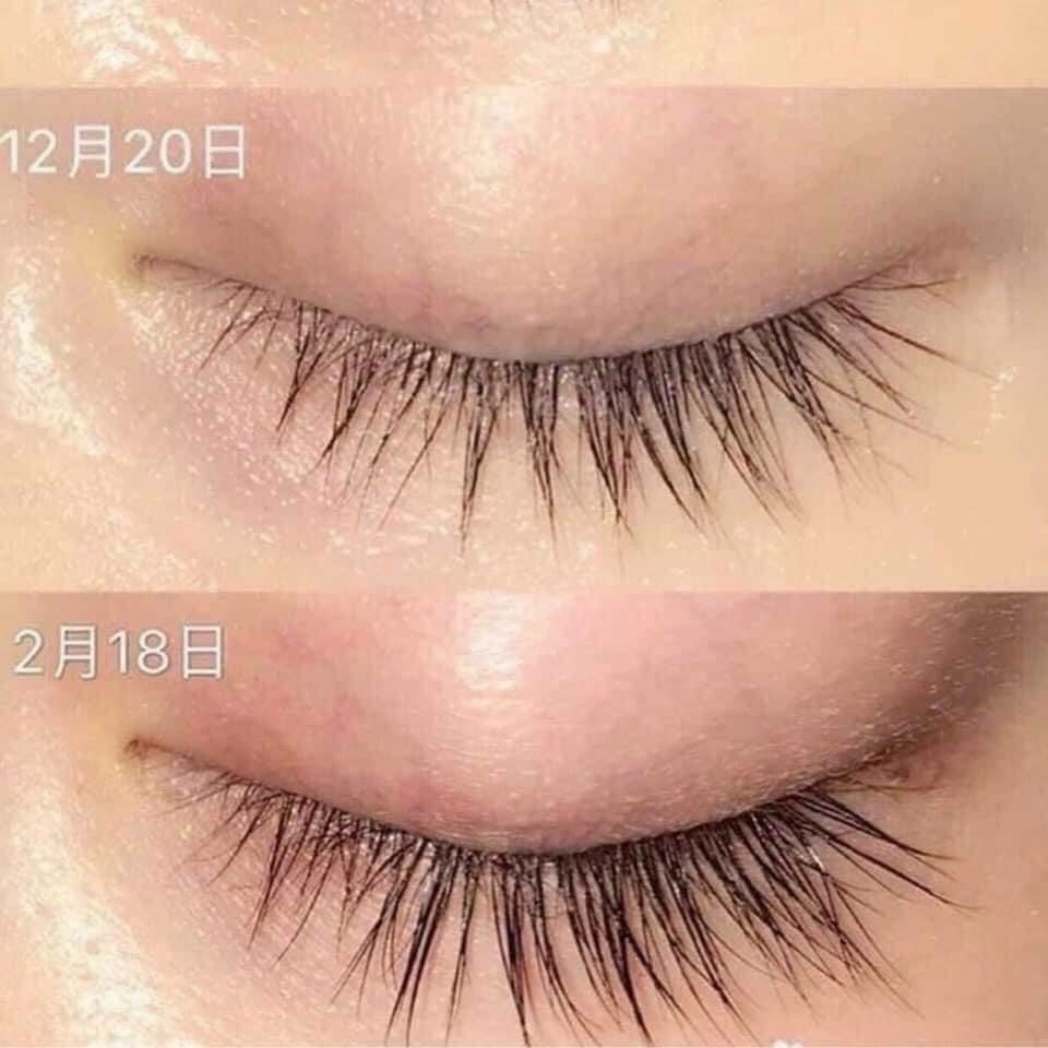 Dưỡng mi 4 Long Lashes nội địa Ba Lan