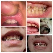 [Chính Hăng] Nước súc miệng sâu răng  trẻ em Mẹ Tấm - Thanh Mộc Hương