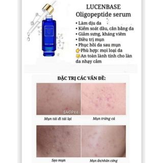Lucenbase Peptide Serum Làm Mờ Vết Thâm