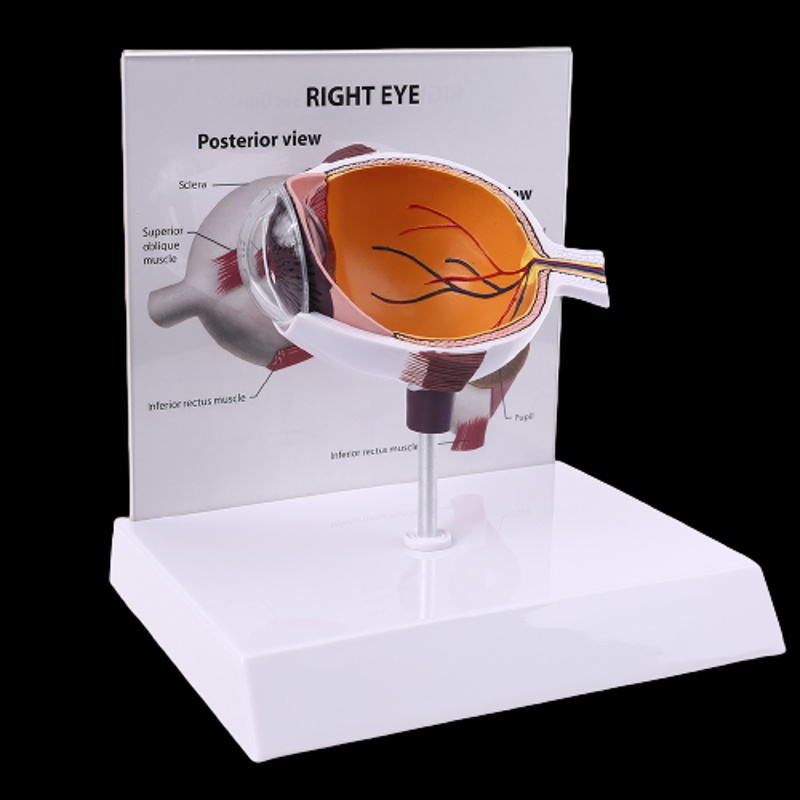 Wer Mô Hình Bóng Mắt Phải Người Cho Trưng Bày Glaucoma Cross Section Anatomical Glaucoma Teac