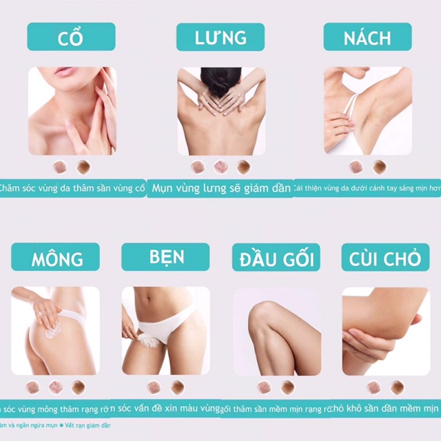 NAKIZ - Kem giảm thâm BODY Nakiz Lively Butt Thái Lan | BigBuy360 - bigbuy360.vn