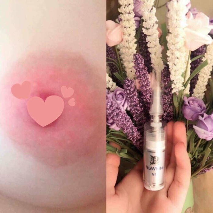 Kem Làm Hồng Nhũ Hoa Nuwhite N1 Mibiti Prudente 5ml