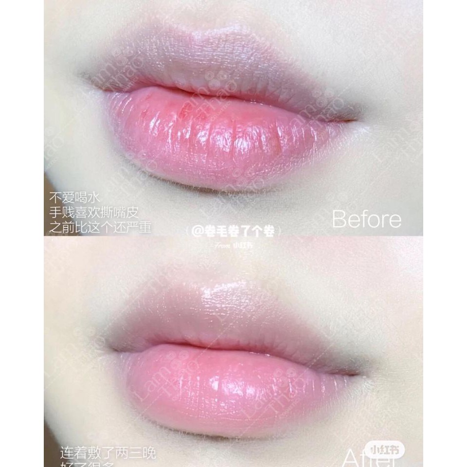 Mặt Nạ Ngủ Dưỡng Ẩm Cho Môi YNM Lip Treatment Pack