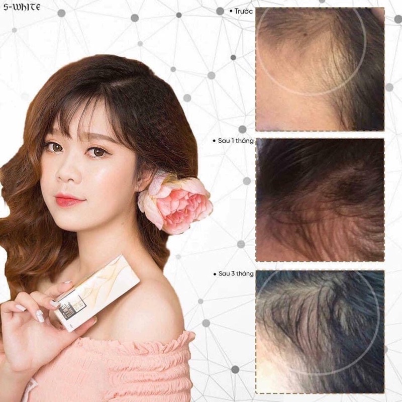 Tinh chất kích thích mọc tóc Swhite