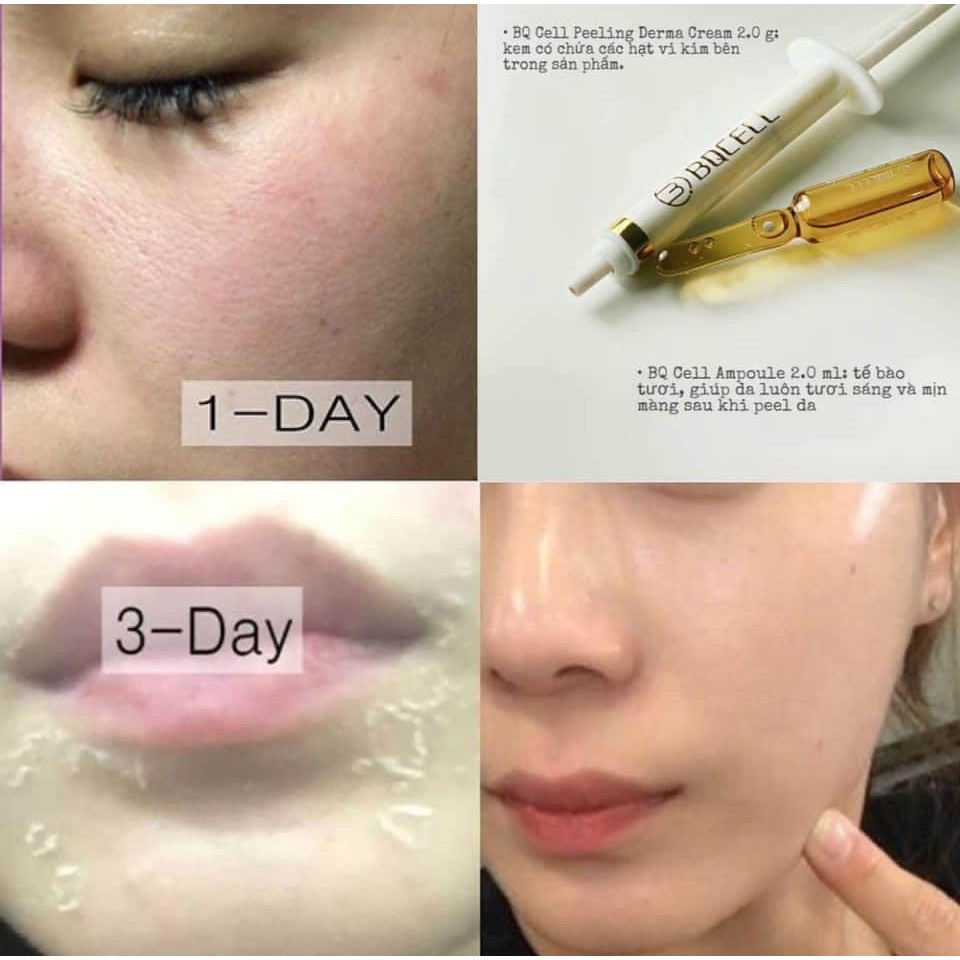 Thay Da Sinh Học - Peel Da Vi Tảo Bqcell  2G