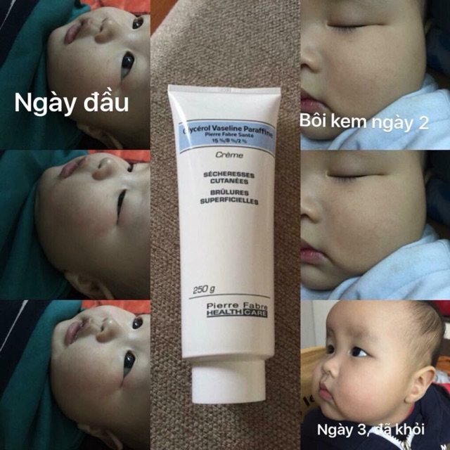 Kem nẻ Dexeryl 250g | BigBuy360 - bigbuy360.vn